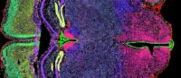 Imagen de la expresión génica espacial, con STOmics, de tejido fresco congelado de cerebro de ratón. Resultados producidos desde la Unidad de Servicios Científicos - Genómica del Parque Cientifico de Madrid (PCM) en colaboración con las unidades de Histología y Microscopía del CNB.