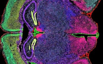 Imagen de la expresión génica espacial, con STOmics, de tejido fresco congelado de cerebro de ratón. Resultados producidos desde la Unidad de Servicios Científicos - Genómica del Parque Cientifico de Madrid (PCM) en colaboración con las unidades de Histología y Microscopía del CNB.